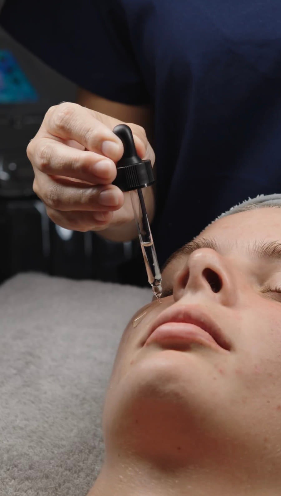 Microneedling
